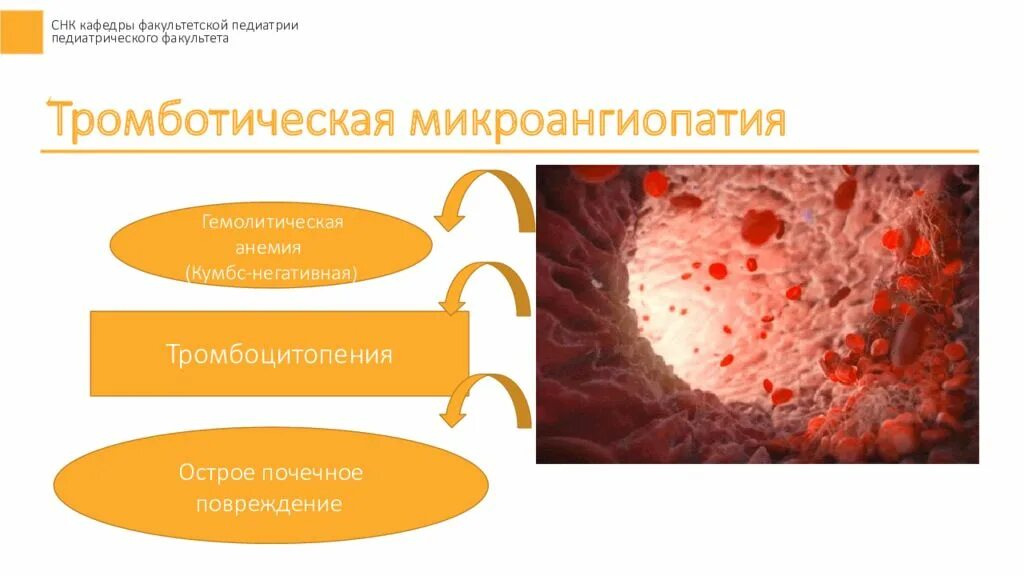 Микроангиопатия что это значит. Тромботическая микроангиопатия. гемолитико-уремический синдром у детей. тромботические микроангиопатические гемолитические анемии. микроангиопатия почек.
