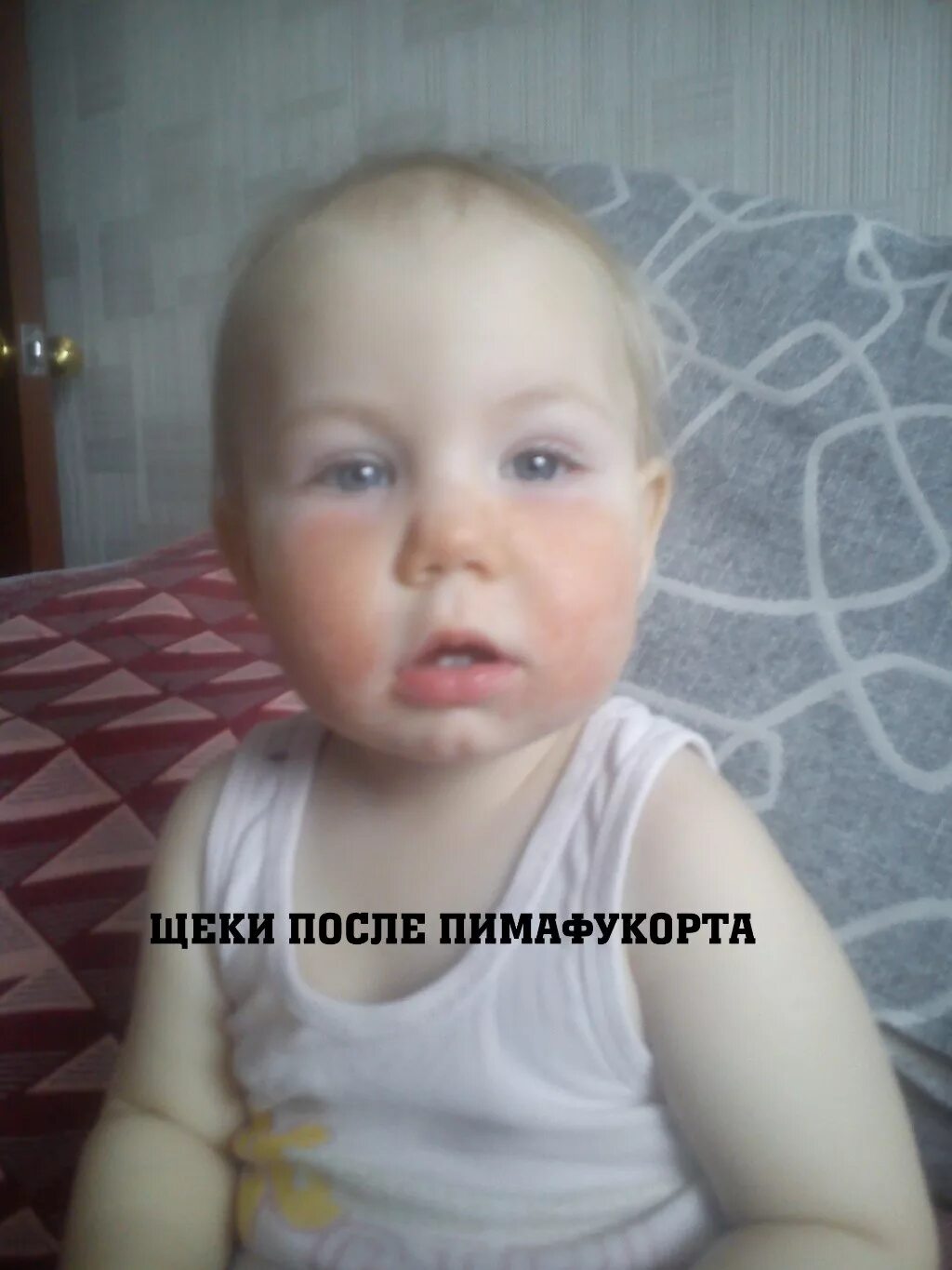 Ребенок белеет. Ребенок белеет