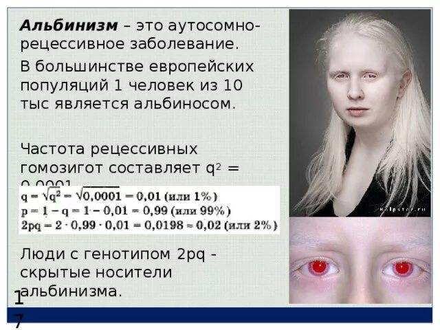 Альбинизм генетика. Альбинизм наследственное заболевание. альбинизм генная мутация. альбинизм тип наследования.