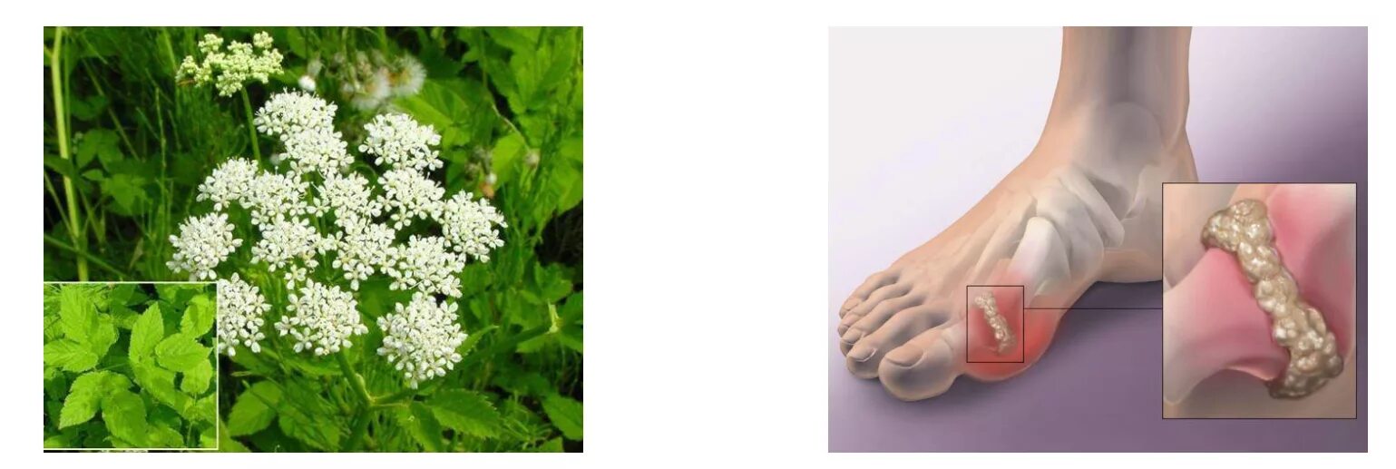 хрен корнеплод. беловодье побеги пырей 50 г. корень бедренца камнеломки. корень от подагры. русские корни сбор тибетский омоложение 100 г.