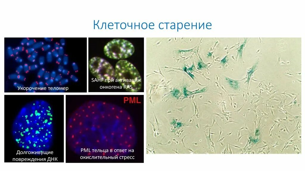 Химические изменения клеток. Старение клетки. Клеточные механизмы старения. Клеточная теория старения. Старение клеток человека.