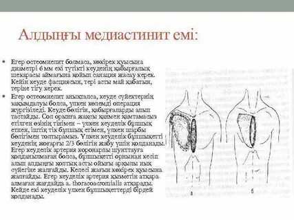 Операция коль