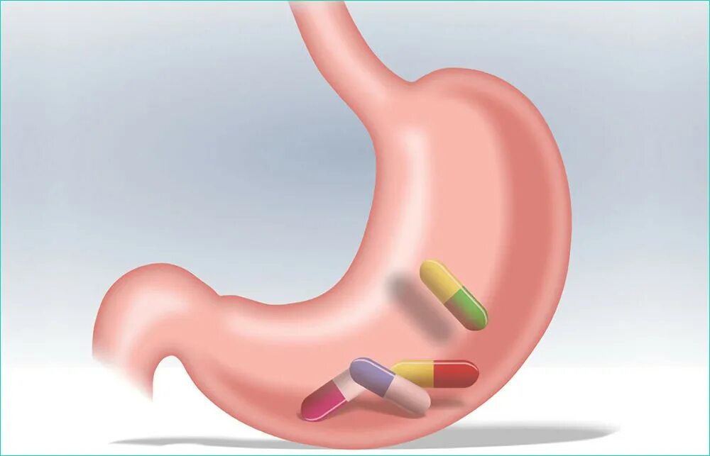 Лекарственная болезнь желудка. Фармакотерапия язвенной болезни желудка. Таблетки для желудка.