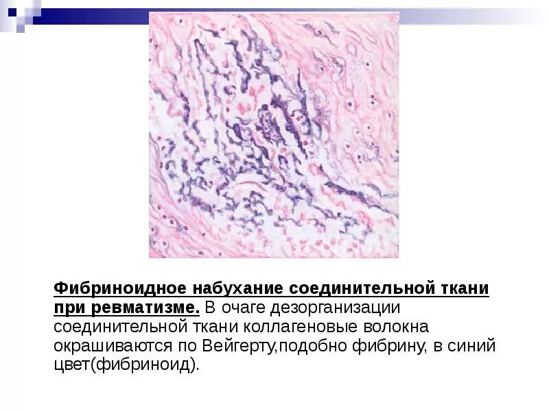 Изменение тканей