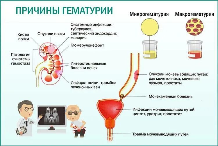 Почему какую кровью