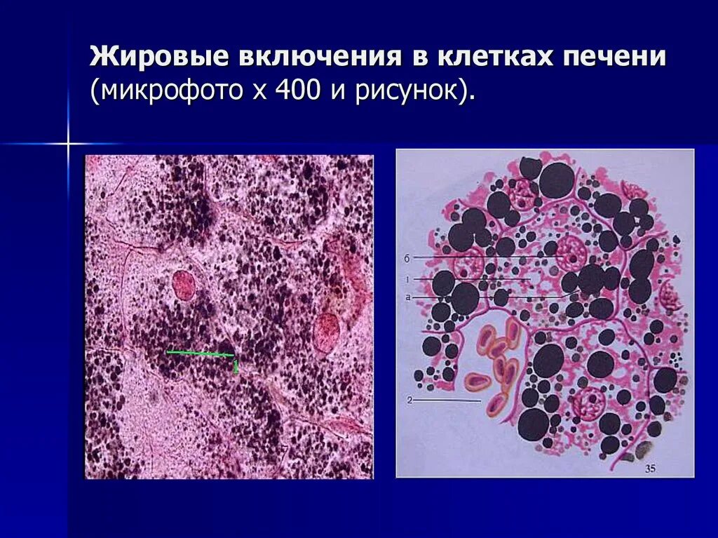 Какие клетки в печени. Жировые включения препарат гистология. Включения жира в клетках печени. Липидные включения в клетках печени. Включения жира в клетках печени аксолотля.