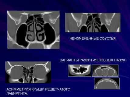 Соустье это