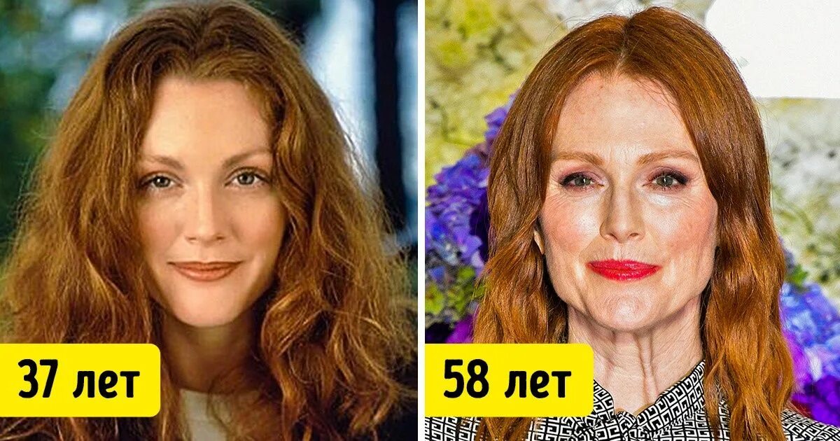 Пластика в 50 лет. Джулианна мур в молодости до пластики. джулианна мур в 50 лет. джулианна мур пластические операции. джулианна мур в молодости и сейчас.