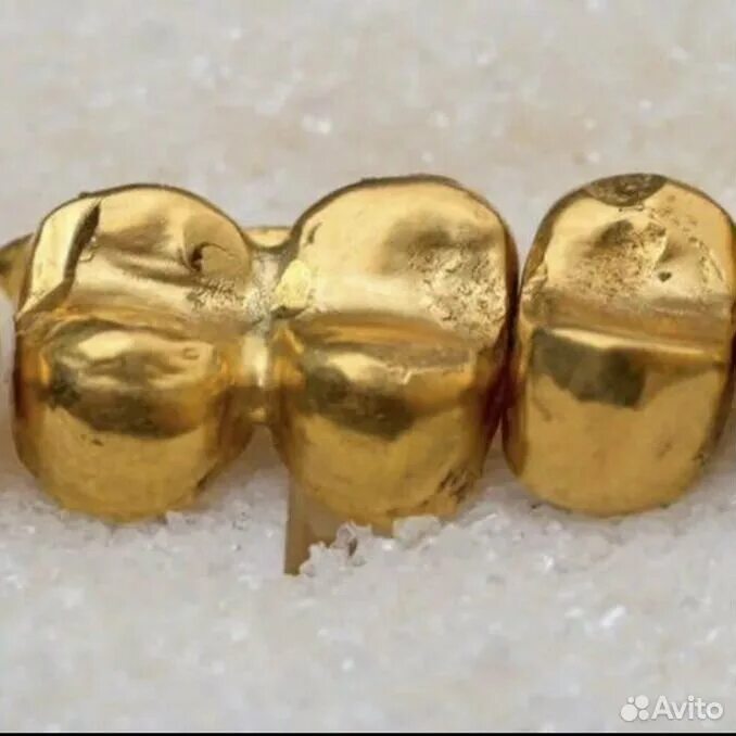 Зубные коронки золото какой пробы. Золотые коронки 750 пробы. Зубные коронки золото какой пробы. Золотые зубные коронки. Золотые коронки 750 пробы.