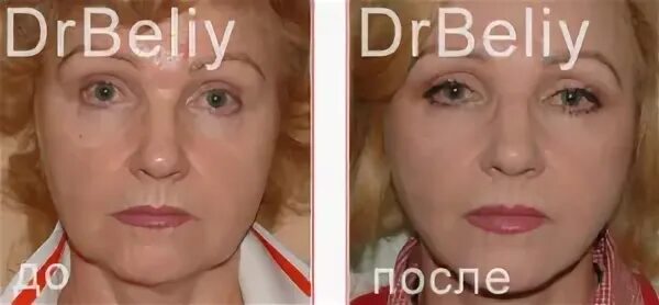 Пластический хирург белый