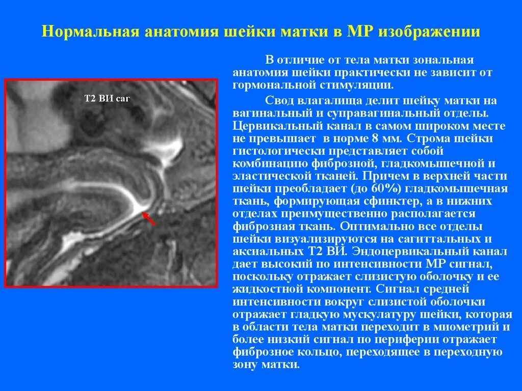 Нормальная анатомия матки. Строение шейки матки анатомия.