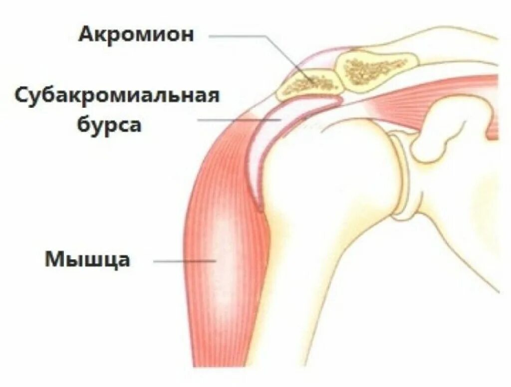 Эффективное лечение плечевого сустава. Субакромиальная сумка плечевого сустава анатомия. Субкоракоидальный бурсит. Субдельтовидно-субакромиальный бурсит плечевого сустава. Субакромиальный импиджмент плечевого сустава.