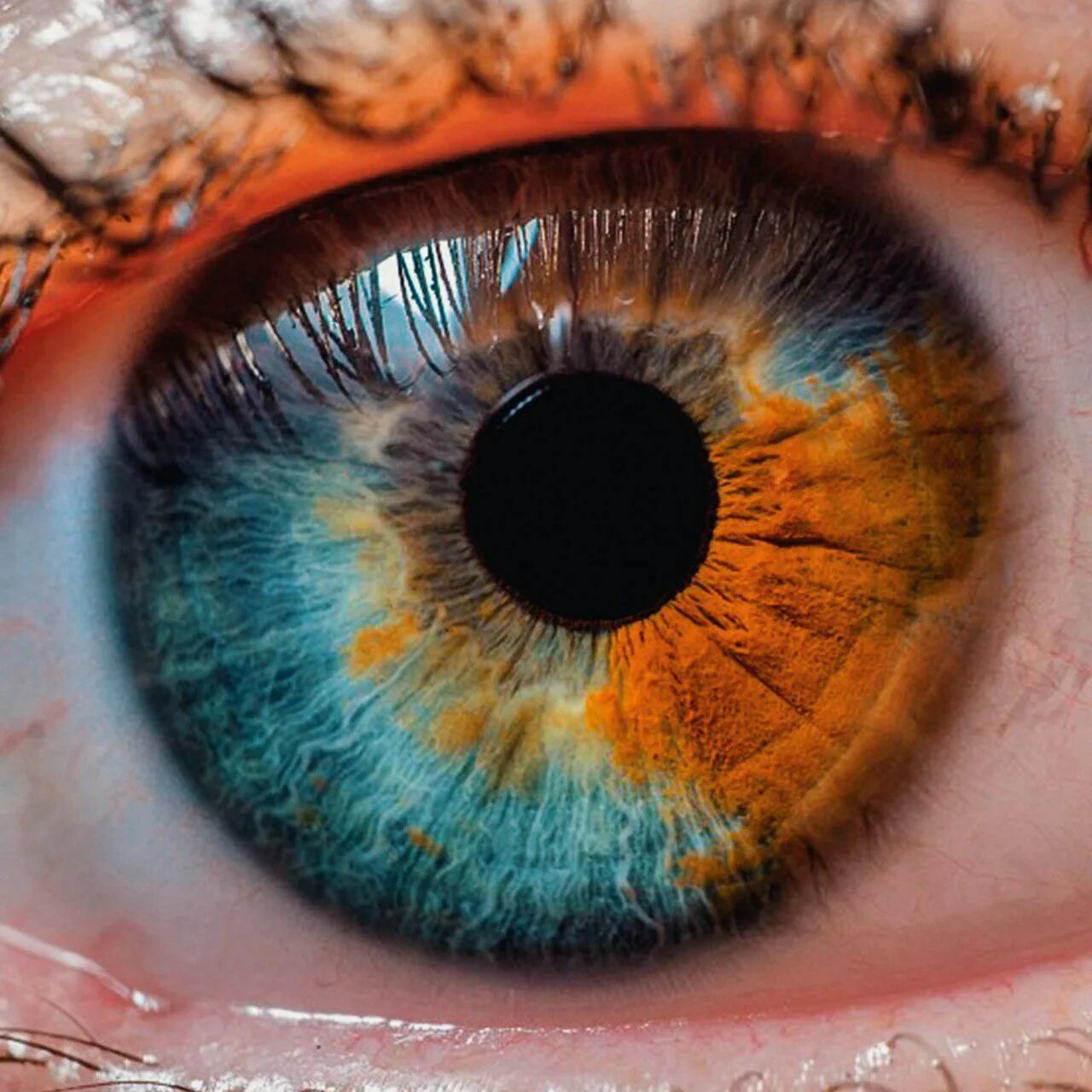 Цвет глаза зависит от пигмента. Гетерохромия радужной оболочки. Секторная гетерохромия глаза. Гетерохромия Радужки глаз. Центральная гетерохромия зрачок.