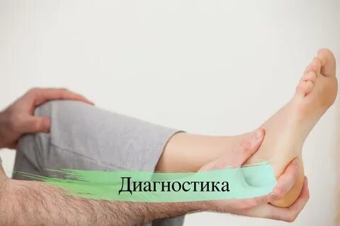 Симптомы пяточной шпоры у женщин после 50