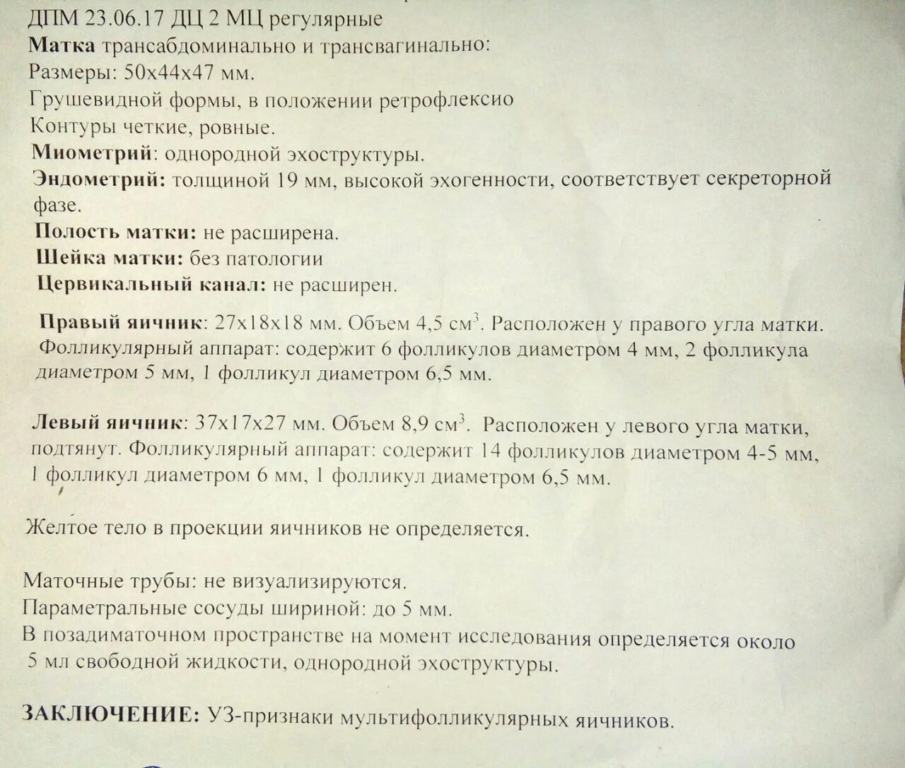 Ретрофлексия матки что это такое. Узи обозначение. обозначения на узи аппаратах. положение матки retroflexio на узи. аббревиатуры на узи аппарате.