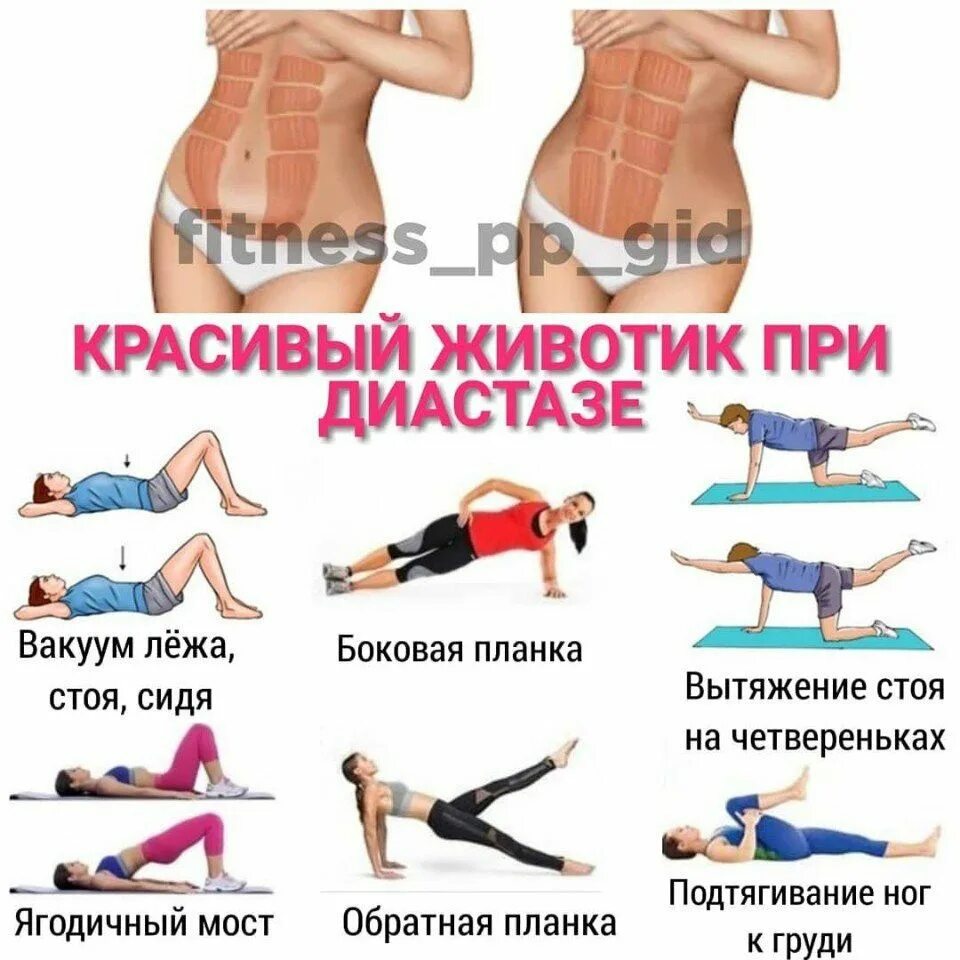 Как после родов похудеть и убрать живот. Упражнения для убирания живота. упражнения для живота при диастазе после родов. упражнения при диастазе мышц живота после беременности. упражнения для пресса при диастазе прямых мышц.