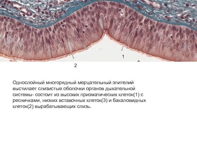 Клетки слизистой полости рта. Многорядный реснитчатый мерцательный эпителий. Реснитчатый эпителий гистология. Эпителиальная ткань мерцательный эпителий. Многорядный призматический мерцательный эпителий трахеи.