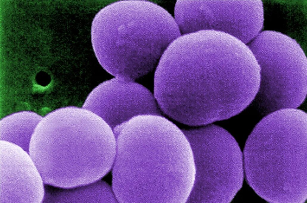 Staphylococcus aureus 4. Стафилококки (s. aureus),. s. aureus золотистый стафилококк. золотистый стафилококк под микроскопом.