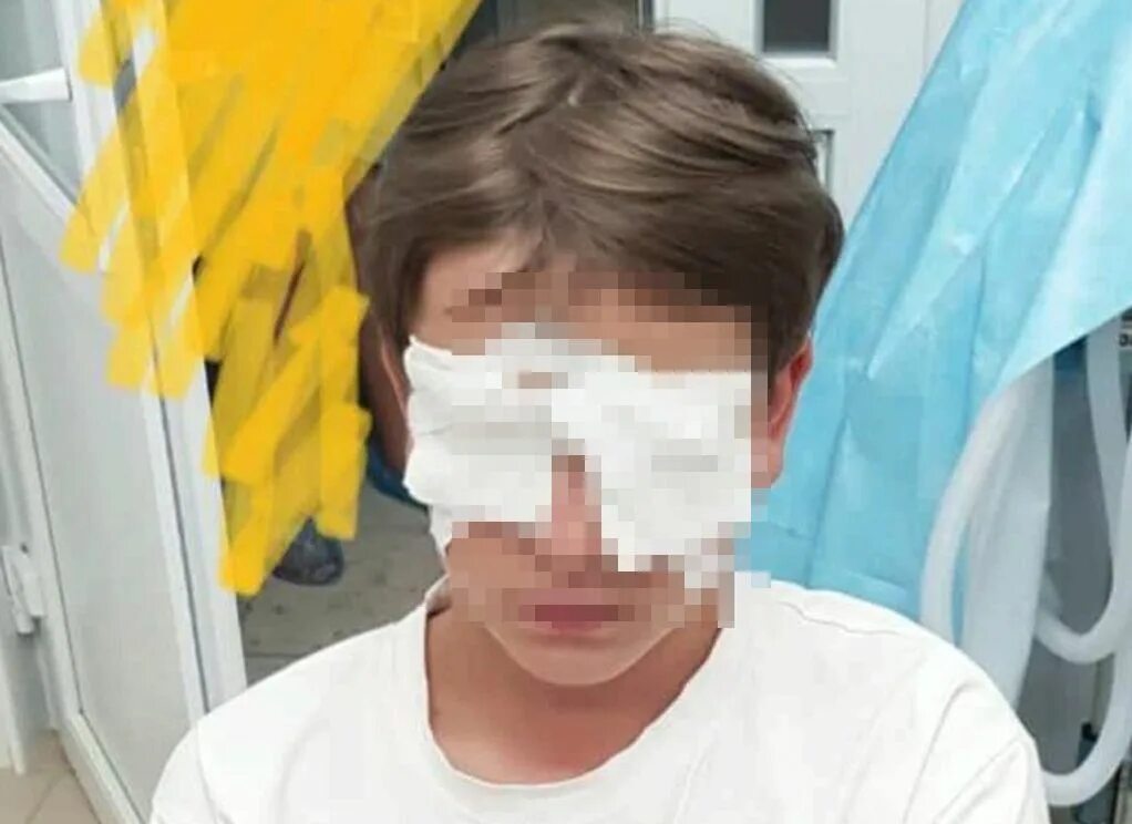 В лагере избили ребенка. Лицо из мальчика. Избили девочку в лагере. Избиение девочки в лагере. В лагере избили ребенка.