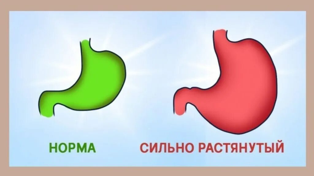 Потянула желудок. Упражнения для снижения аппетита. Симптомы растянутого желудка. Картинку желудка растянутого. Желудок и его части.