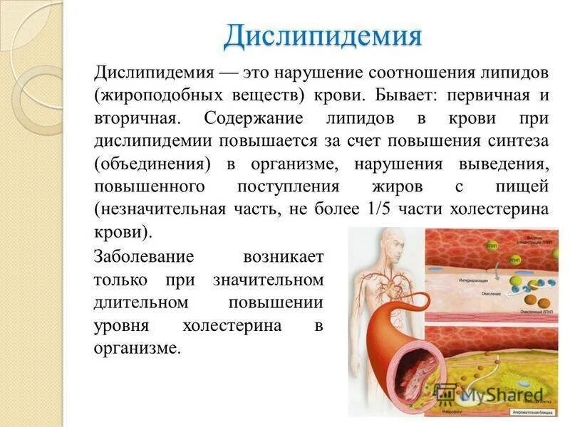 Атеросклероз симптомы причины. Дислипидемия. дислипидемия заболевания. дислипидемии при атеросклерозе. дислипидемия клинические проявления.