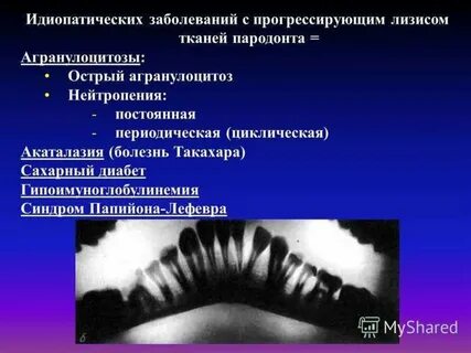 Идиопатические заболевания