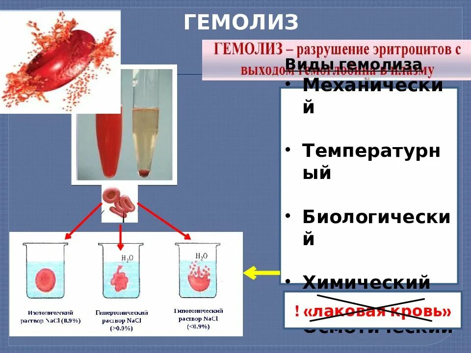 Распад крови. Причины осмотического гемолиза. Гемолиз физиология. Гемолиз эритроцитов лаковая кровь. Гемолиз разрушение эритроцитов.