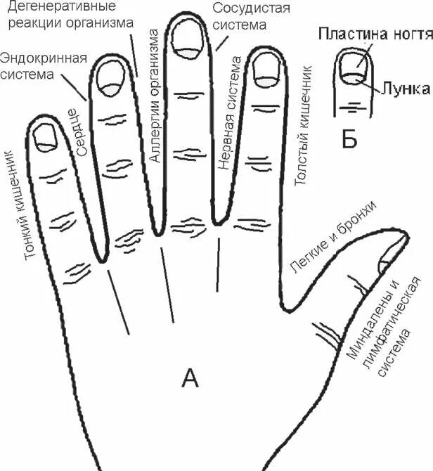 Точки на пальцах что значат. Диагностика по ногтям. Диагностика заболеваний по ногтям пальцев. Диагностика по ногтям на руках. Болезни по ногтям на руках таблица.