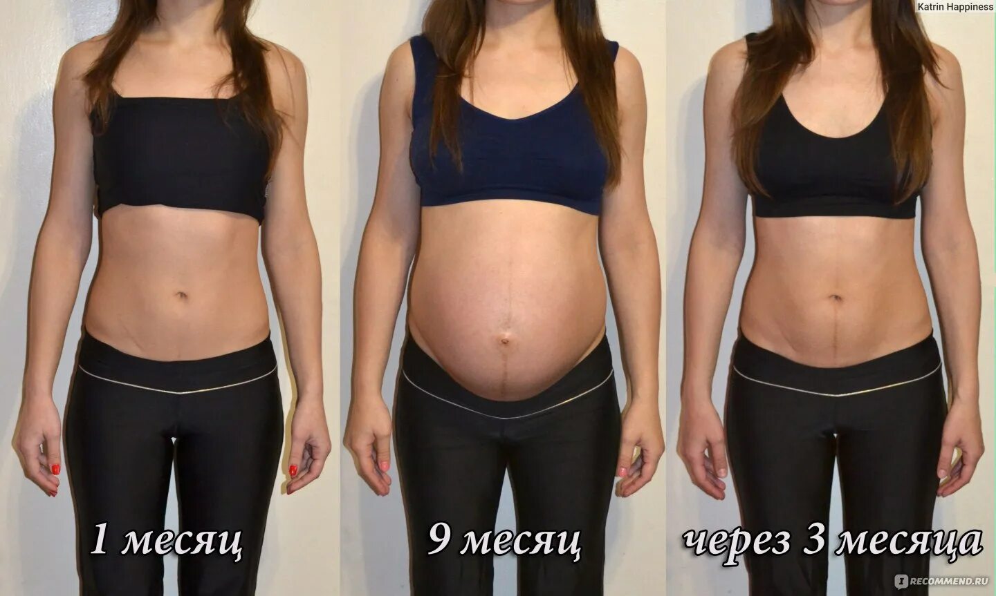 Живот после родов кесарево. Лазерная липосакция галифе. Бедра после родов стали. Стройные ноги до и после. Бедра после родов стали.