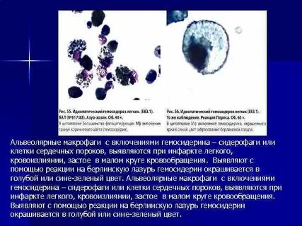 Макрофаги анализ