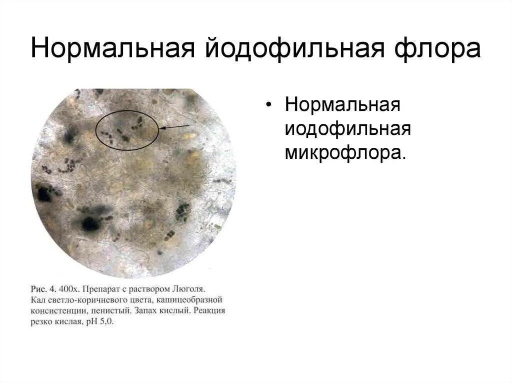 Растительная клетчатка в копрограмме