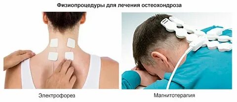 Остеохондроз шейного отдела головы