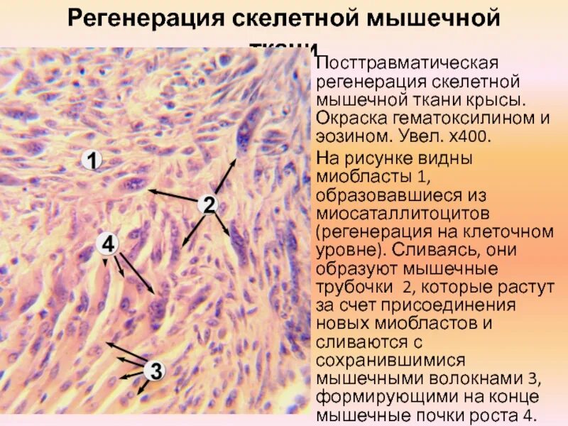 Сателлиты гистология. Регенерация мышечной ткани гистология. регенерация гладкой и поперечно-полосатой мышечных тканей. регенерация гладких миоцитов. регенерация поперечно полосатой скелетной мышечной ткани происходит.