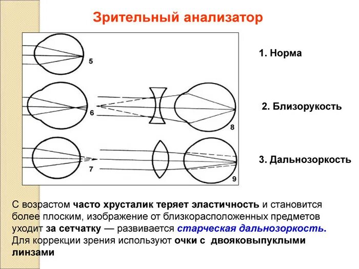 Близорукость категория. Зрительный анализатор дальнозоркость и близорукость. зрительный анализатор нарушение зрения. оптическая система зрительного анализатора. показатели близорукости и дальнозоркости.