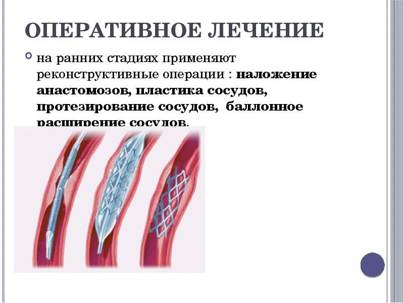 Лечение облитерирующего атеросклероза нижних. Облитерирующие заболевания сосудов конечностей. облитерирующий атеросклероз клиника. облитерирующие заболевания сосудов нижних. облитерирующие поражения артерий хирургия.