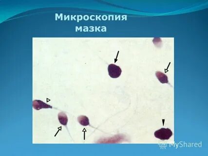 Микроскопия мазка