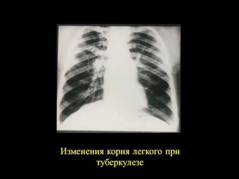Корни несколько расширены