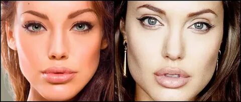 Женщина сделавшая скулы