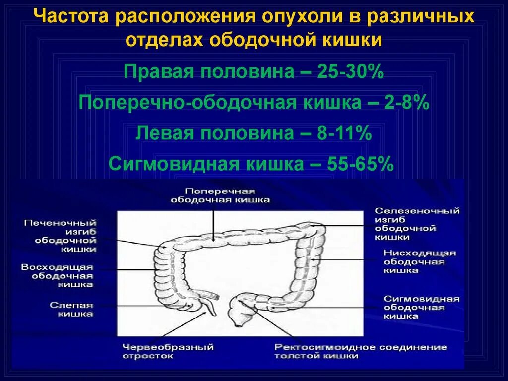 Область сигмы. Проксимальный отдел толстой кишки. Классификация опухолей сигмовидной кишки. Опухоль ободочной кишки. Злокачественная опухоль ободочной кишки.