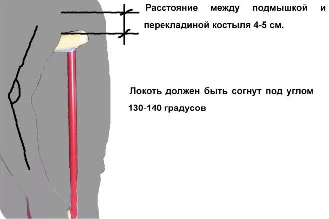 Как правильно подобрать костыли. Как правильно отрегулировать костыли. Как отрегулировать костыли под рост. Как настроить костыли подмышечные. Костыли подмышечные правильная регулировка.