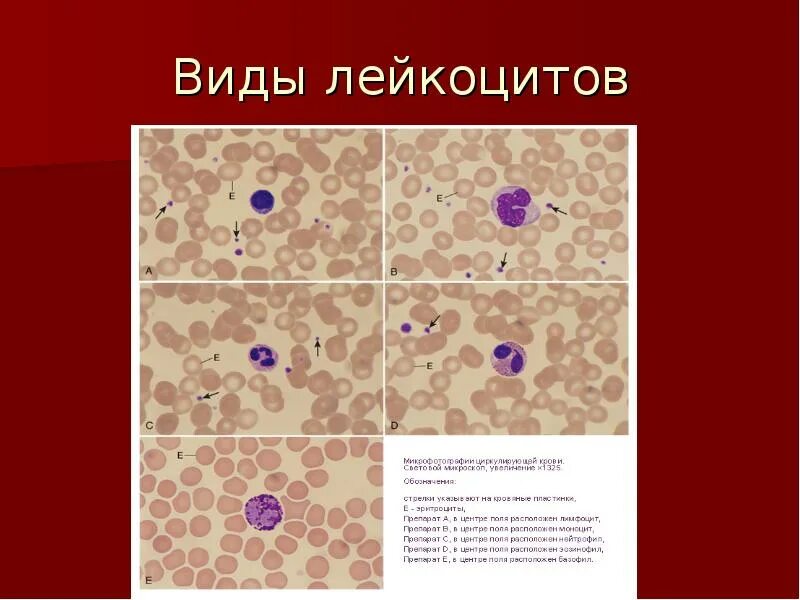 Лейкоциты группа крови. Разновидности лейкоцитов. Лейкоциты виды лейкоцитов. Лейкоциты группа лейкоцитов. Перечислите основные виды лейкоцитов:.