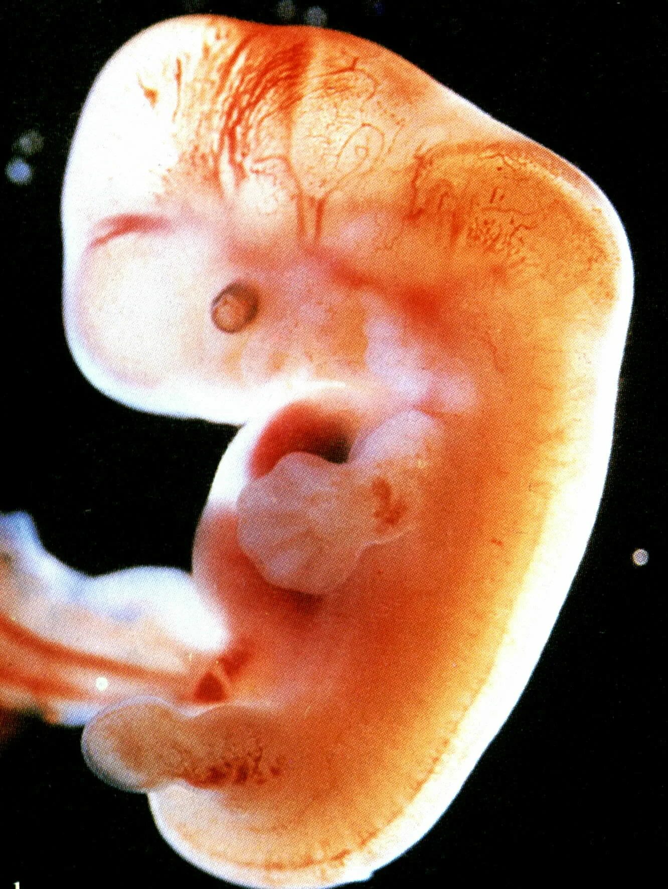 5 акушерская неделя. Эмбрион на 4-5 неделе беременности. Зародыш 3-4 недели беременности. Эмбрион на 4 неделе беременности. Зародыш на 5 неделе беременности.