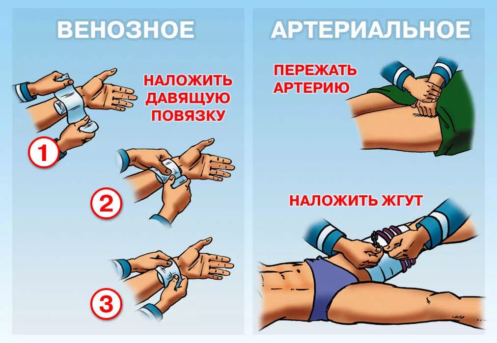 1 помощь при открытом кровотечении. Оказание первой помощи при артериальном и венозном кровотечении. венозное кровотечение наложение жгута. артериальное и венозное кровотечение первая помощь. виды кровотечений первая помощь при артериальном кровотечении.