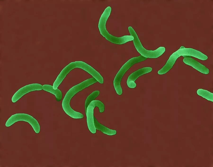 Бактерии изогнутой формы носят название. Холерный вибрион. Холерный вибрион это бактерия. Вибрионы бактерии. Холероподобный вибрион.