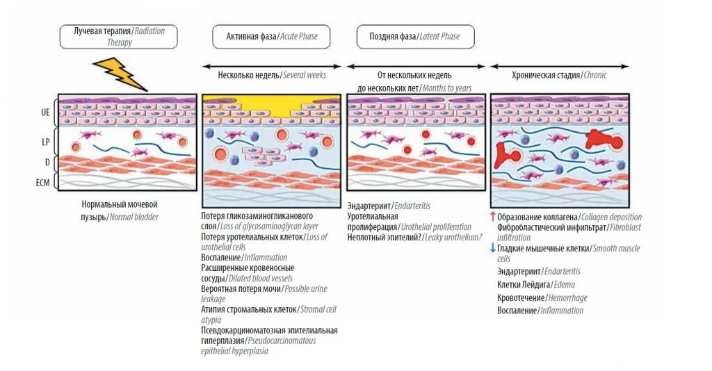 Патогенез цистита схема. Механизм развития цистита. Цистит патогенез. Патогенез лучевого цистита. Лучевой цистит лечение