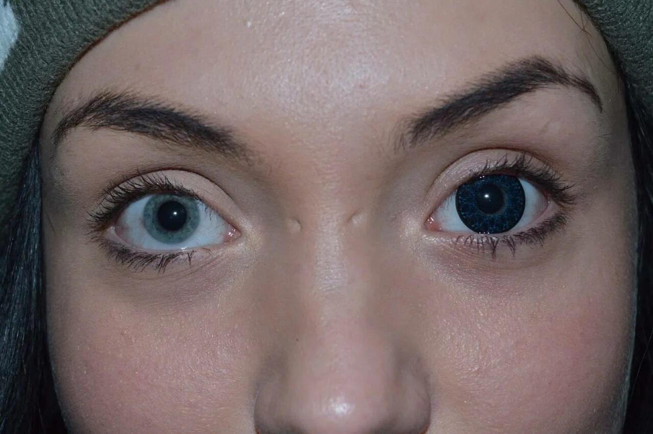 Линзы в глаза операция. Голубые линзы на карие глаза. Синие линзы на карие глаза. Голубые линзы на карие. Цветные линзы карие.