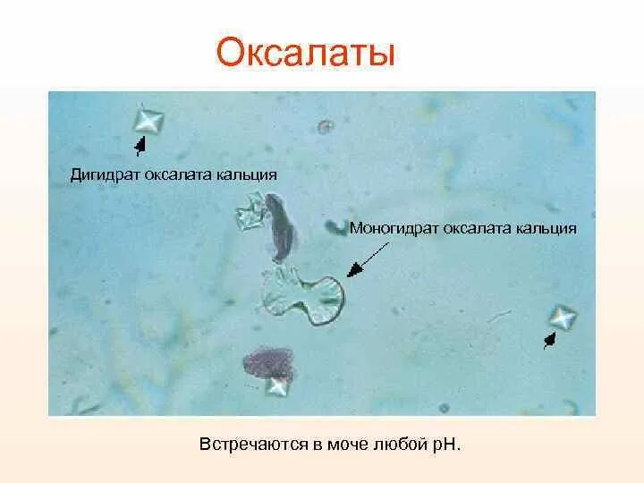 Оксалат кальция моногидрат в моче. Кристаллы моногидрата оксалата кальция. Кристаллы оксалата кальция дигидрат. Оксалаты в моче микроскопия. Кристаллы кальция в моче у мужчин