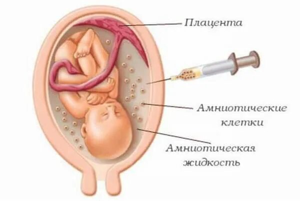 Околоплодные воды - что это, функции, откуда берутся, норма