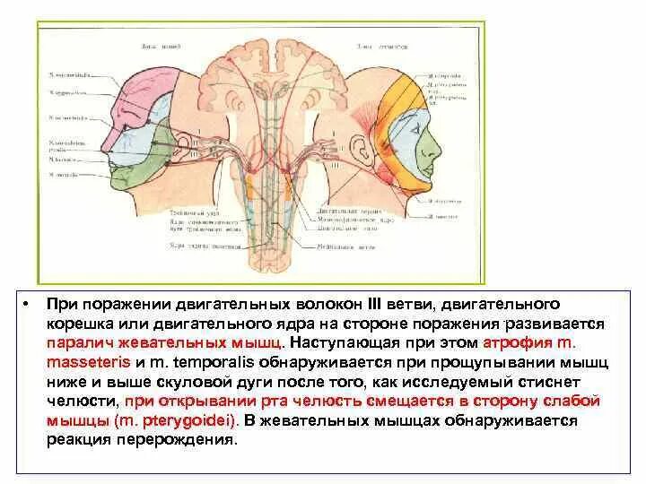 Поражение ствола головного. Парабрахиальное ядро ствола мозга. Поражение ствола головного мозга. Поражение ствола головного мозга симптомы. Поражение ствола мозга с черепными нервами.