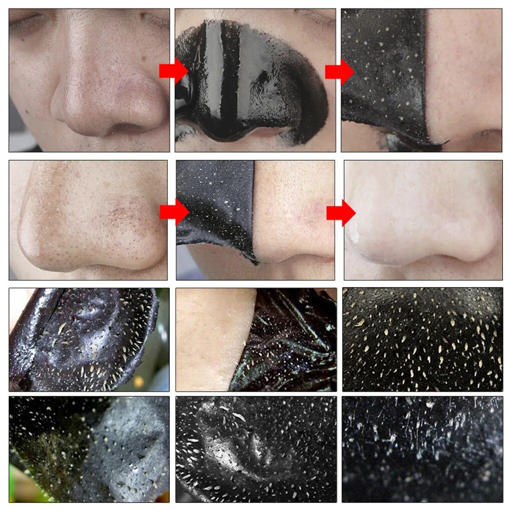Как использовать маску от черных точек